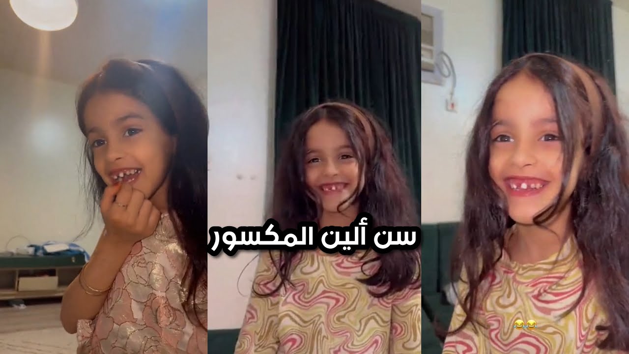 سن ألين المكسور🦷😂 | سنابات زايد بن سابر