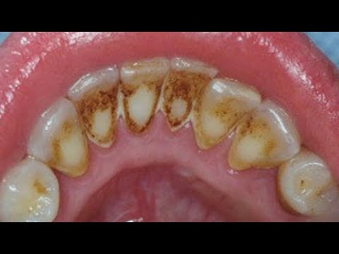 Как отбелить желтые фары