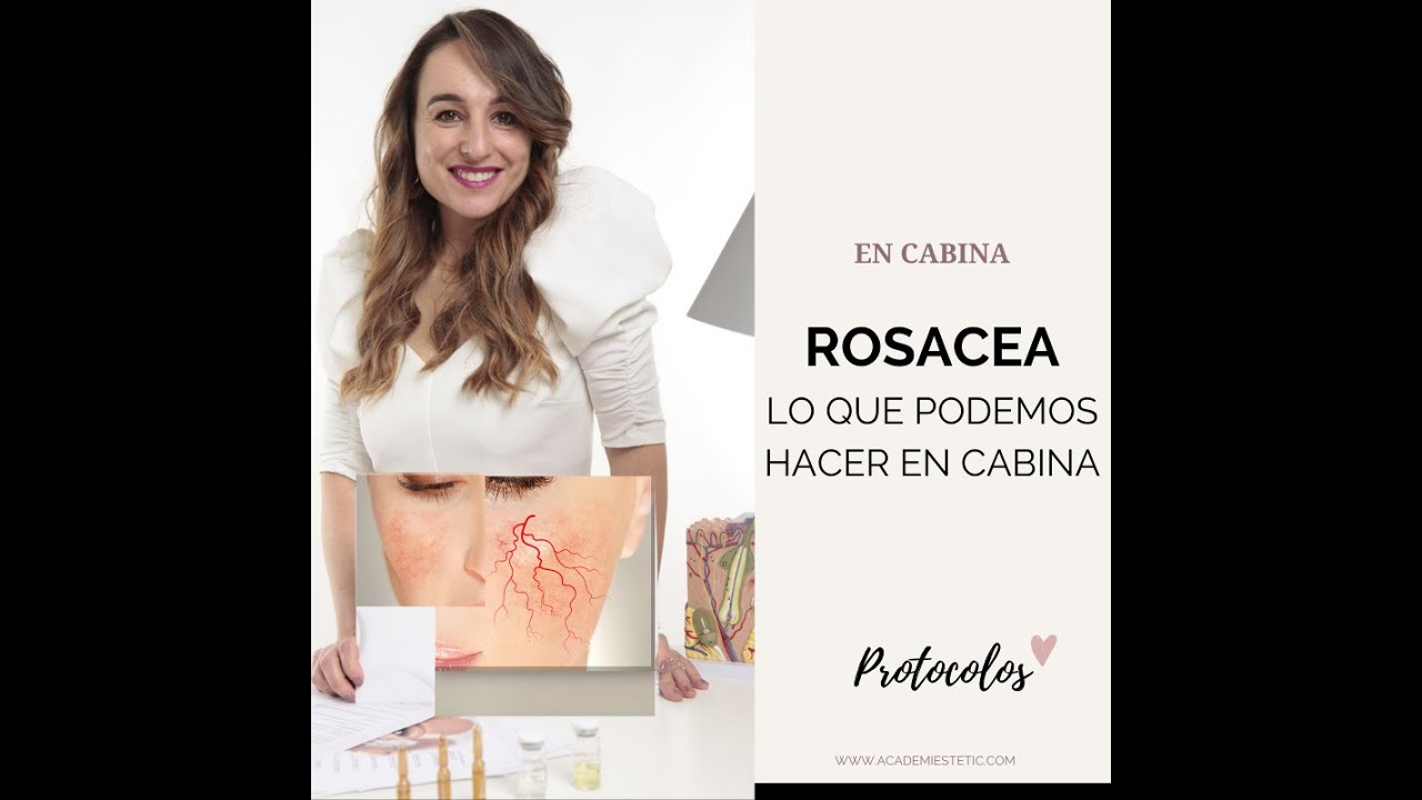 ROSACEA que es y como tratarla