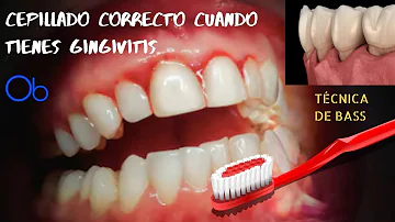 ¿Cómo se elimina la sangre al cepillarse los dientes?