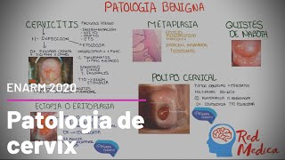 Cervical cancer (CC), cervicitis, and other cervical pathologies #ENARM screenshot 5
