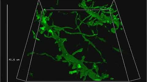 Olympus SpinSR10 | 3D Time-Lapse of a Neuron