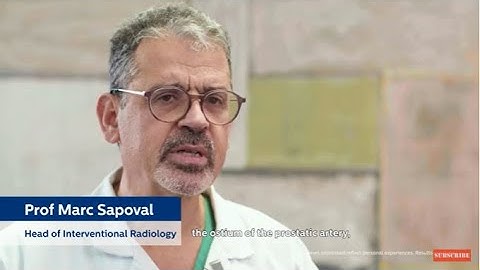 Prostate Artery Embolization with Philips SmartCT