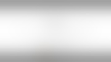 EZgoma™ - Full Maxilla Reconstruction using Zygomatic and Pterygoid Implants. Dr. Pawel Schwartzmann