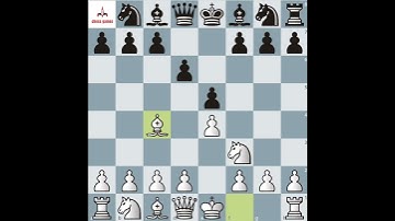 Checkmate In just 10 seconds. 🥵 #chessplayer