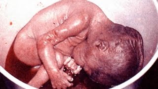 The Reality of Abortion - Aborted Babies for Sale
