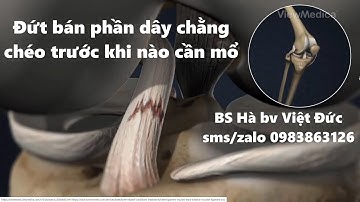 ĐỨT BÁN PHẦN DÂY CHẰNG CHÉO TRƯỚC - KHI NÀO CẦN MỔ