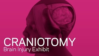 Craniotomy - Traumatic Brain Injury Animation