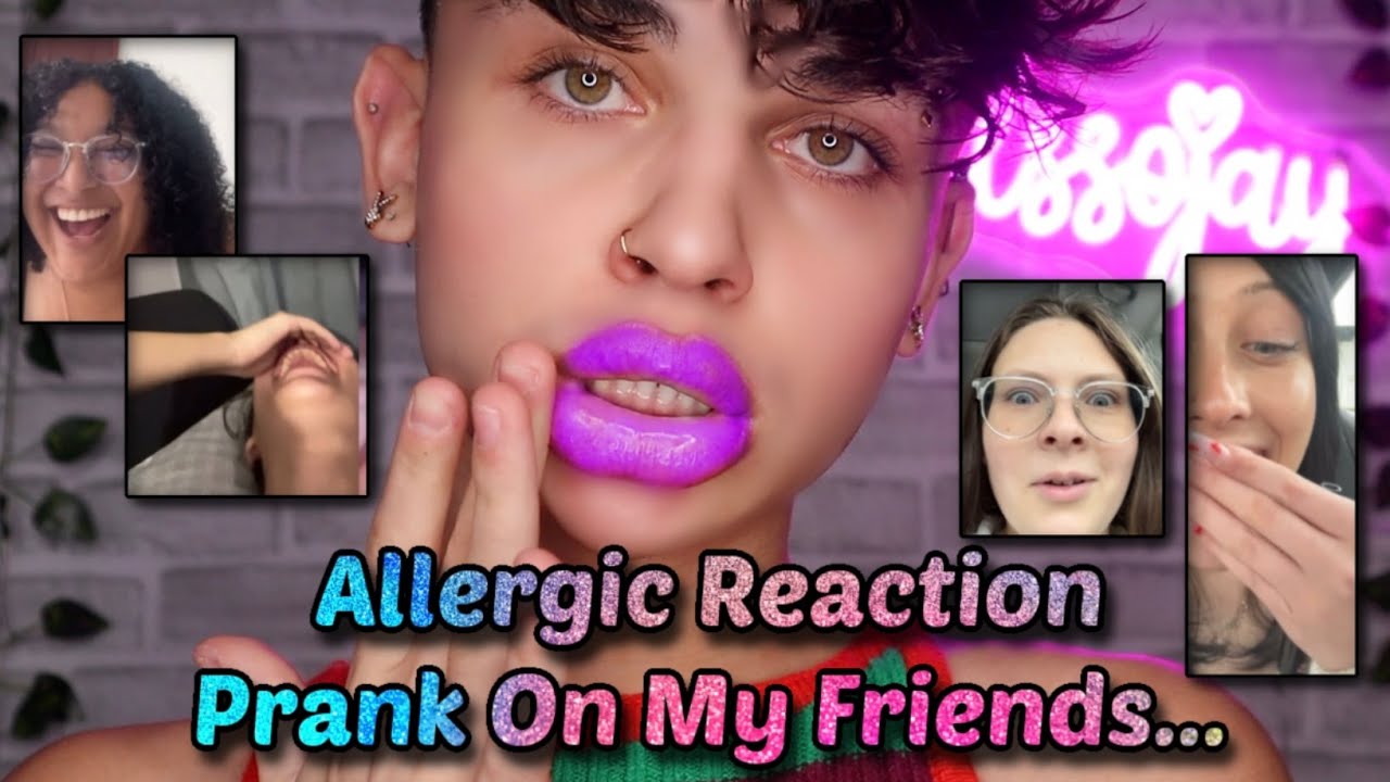 Allergic Reaction Prank On My Friends... (LIP PLUMPER) YouTube