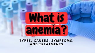 Which Are the Signs of Anemia? Learn How to Identify and Take Action!