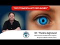 "Corneal &amp; Eye Transplant: Complete Guide | Dr. Trush Explains"