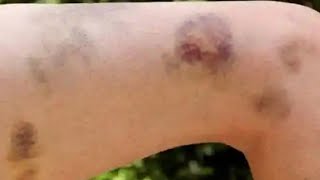 Parents install a camera in daughter's room to see why she consistently wakes up with bruises.