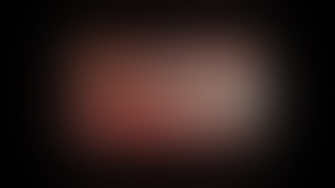 Laparoscopic radical nephrectomy