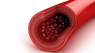 Autoinmune vasculitis pantalla