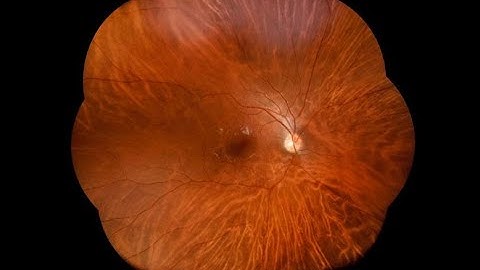 EYER Handheld Portable Camera (Phelcom) | Vision Expo East 2024