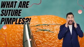 WHAT ARE SUTURE PIMPLES?!