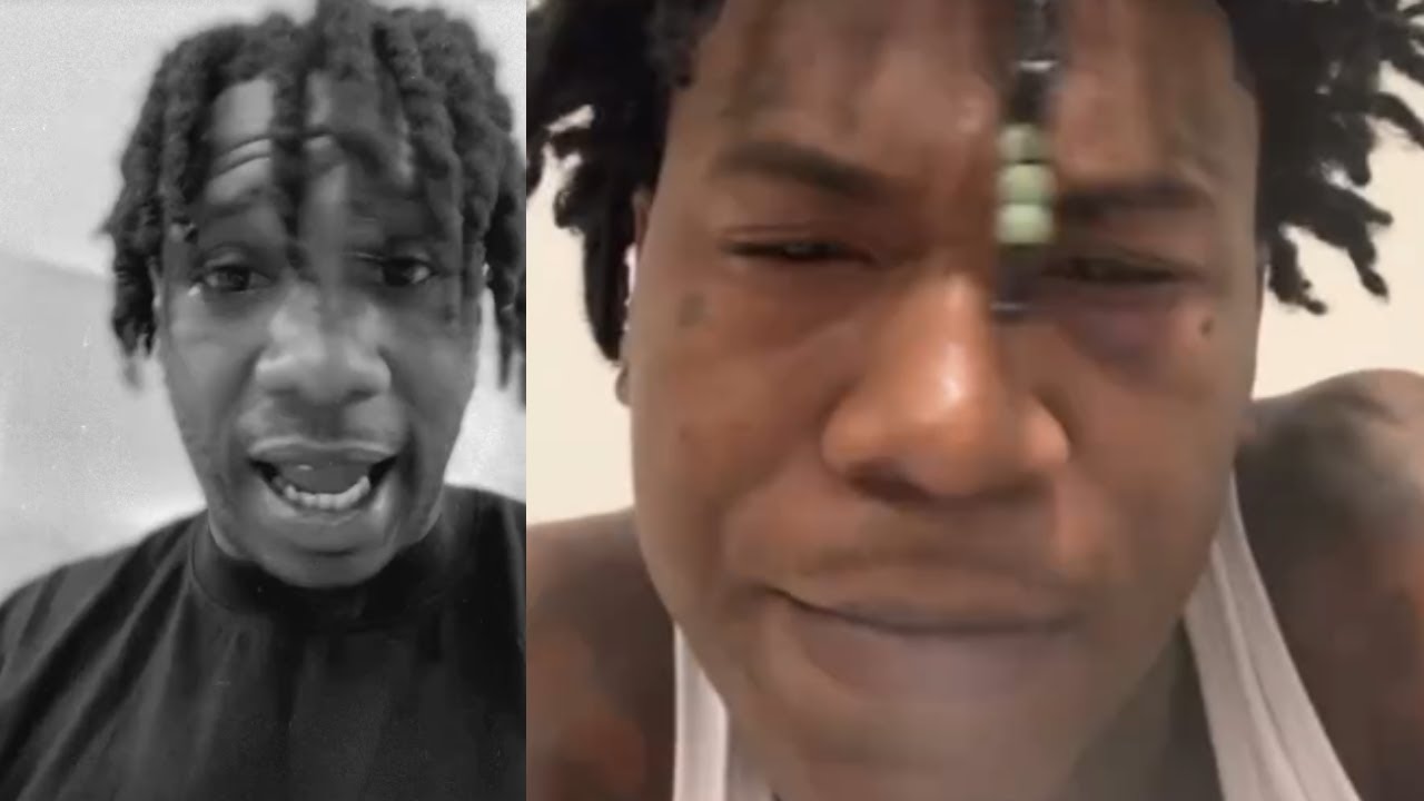 Бен 10 Большой Брат уходит, увидев свой синяк под глазом