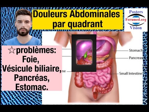 Vidéo: La constipation causera-t-elle des douleurs dans le bas du dos ?