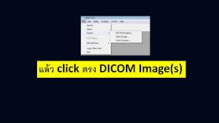 Efilm การโหลดขอมลลง Efilm