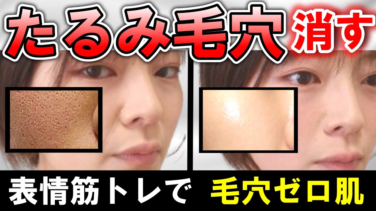 【たるみ毛穴が消えた！！】顔トレーニングで伸びた頬の毛穴をキュッとたるみ上げ！