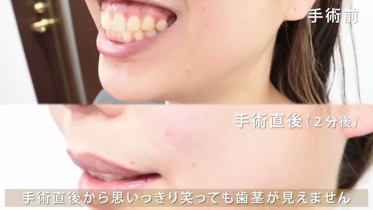 審美歯科治療メニュー | 美容整形の【共立美容外科】