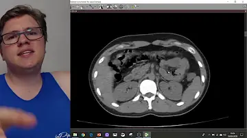 Quanto custa uma tomografia da barriga?