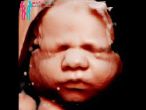 Do babies cry in the womb? - YouTube
