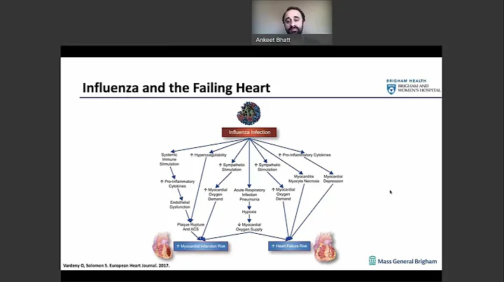Quick Tips on the Impacts of Influenza Infection and Vaccination on CV Outcomes