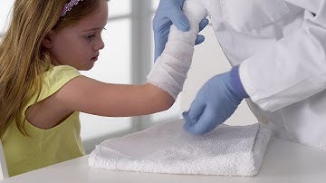 3M™ Scotchcast Reverse Sugar Tong Splint Application