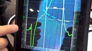Famous AirStrip Shows Cardiology App At HIMSS 2011 Profile