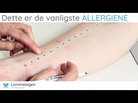 Video: MSG-allergi: Symptomer, Testing Og Behandling