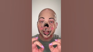 - jetzt weiß ich es besser & umgebe mich nicht mit solchen Menschen!❤️ #alopecia #nohair #glatze
