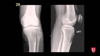 Radiology Boards Prep - MSK Cases