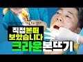 성공적인 치아크라운 치료를 위한 본뜨기/인상채득