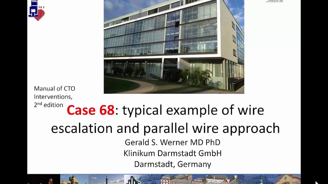 Case 68 Manual of CTO Interventions Parallel wiring YouTube
