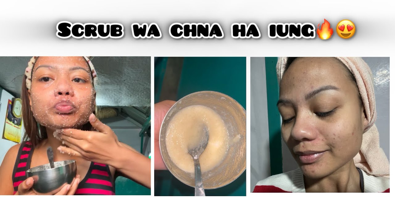 Домашний скраб Iow Pynwiar от белых угрей и черных точек😍|гладкая и мягкая кожа🔥