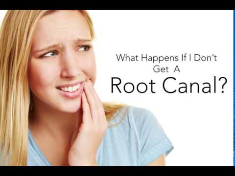 What Happens If I Don't Get A Root Canal?