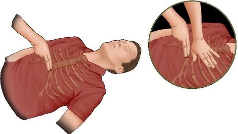 POCUS in Cardiac Arrest_Snippet_Dr Pradeep Rangappa