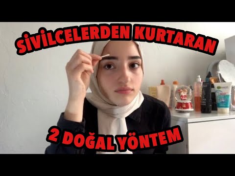 SİVİLCELERDEN 1 GECEDE KURTARAN 2 DOĞAL ÇÖZÜM! (EVDE)