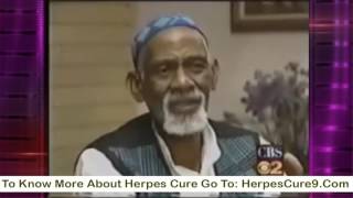 Dr  Sebi On Herpes Cure | Natural Cure For Herpes By Dr Sebi(, 2016-12-16T12:37:31.000Z)