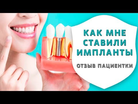 Имплантация зубов или съёмные зубные протезы. Отзыв пациентки об имплантации зубов | Дентал ТВ
