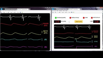 Directed OR Training Using UniMocX