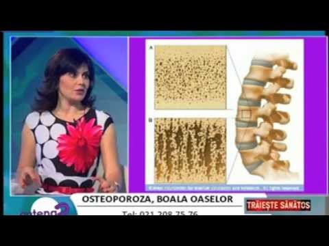 Video: Osteoporoza: Sănătatea Oaselor și Menopauză