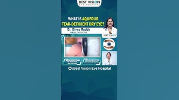 Aqueous Tear-Deficient Dry Eye || Best Vision Eye Hospital #shortsfeed