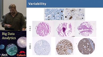 7.5  Thomas Fuchs: Lecture 5: Random Forests in Cancer Research
