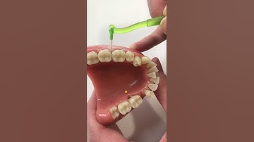 Using an Interdental Brush