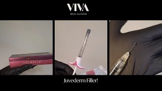 Our Obsession With Juvederm Never Ends  The Best Filler On The Market  beauty fillers