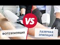 Фотоэпиляция и лазерная эпиляция . Что лучше?