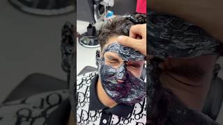 Removal of blackheads from the face😳#fyp #foryou #foryoupage #viral #explore #comedy