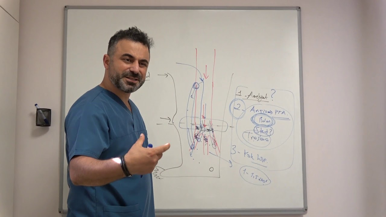 Diyabetik ayak ve şekere bağlı damar tıkanıklığı - Prof. Dr. Ahmet AKGÜL